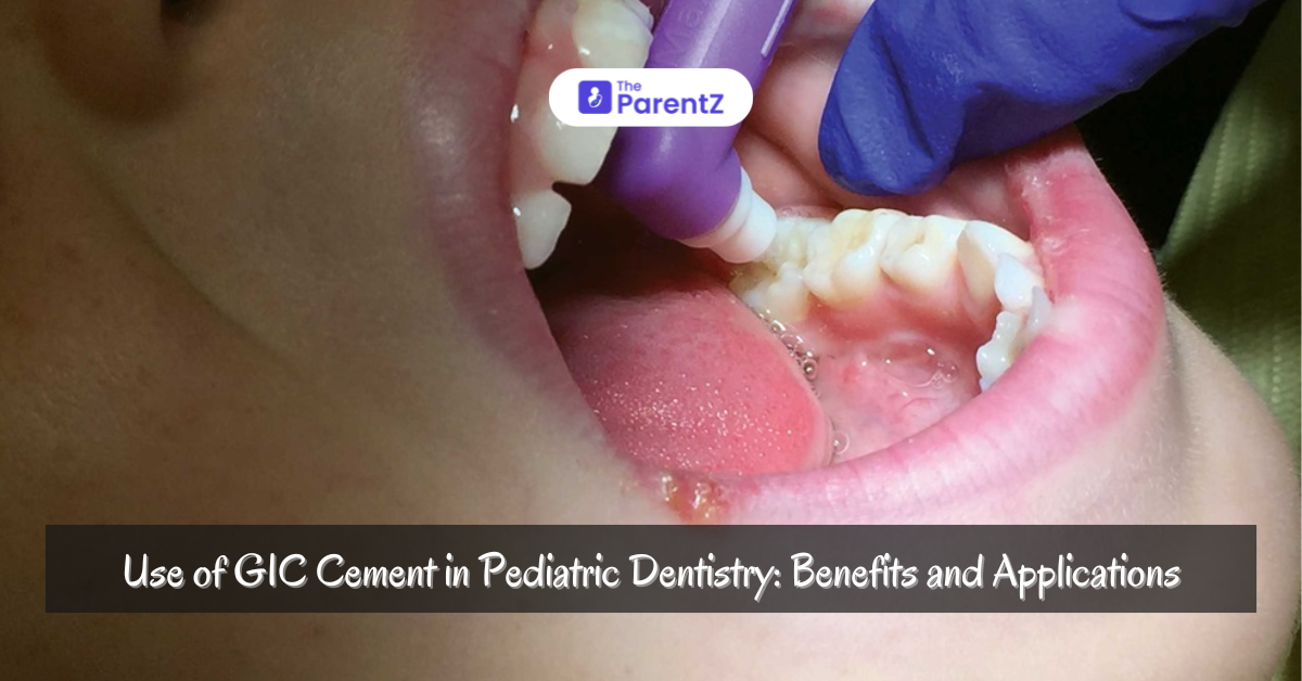 Use of GIC Cement in Pediatric Dentistry: Benefits and Applications