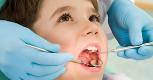 The Essential Benefits of Dental Scaling for Children: A Parent’s Guide