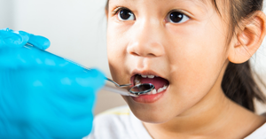 Beyond Cavities: Common Dental Problems in Kids Every Parent Should Know