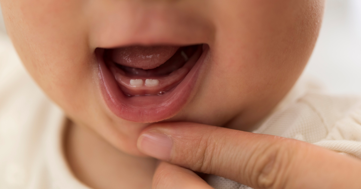 Essential Dental Care for Newborns and Toddlers: Protecting Your Child’s Smile from Day One