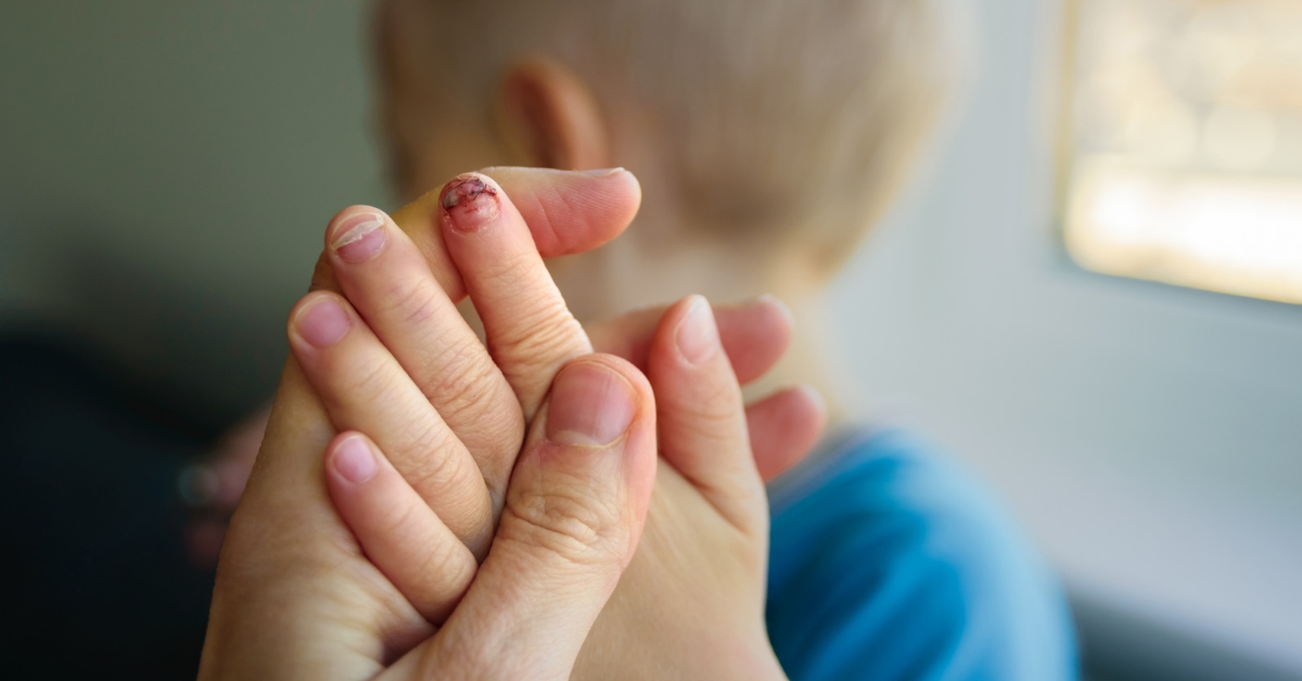 Nail Injuries in Kids: First Aid and Care