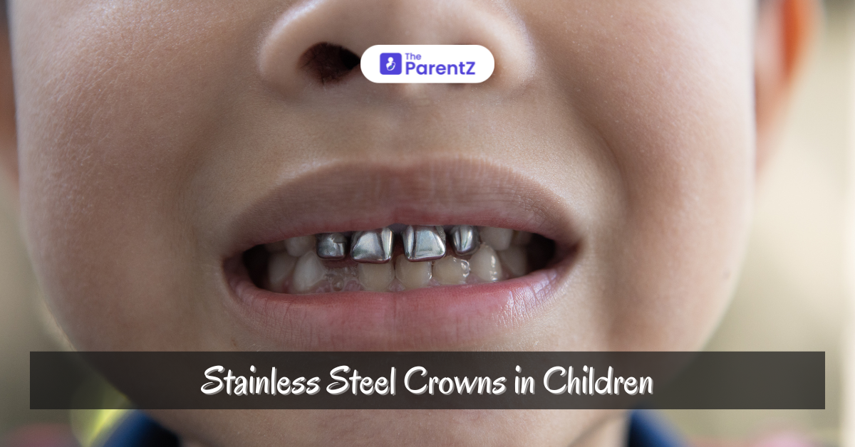 Stainless Steel Crowns in Children: The Best Choice for Pediatric Dental Care