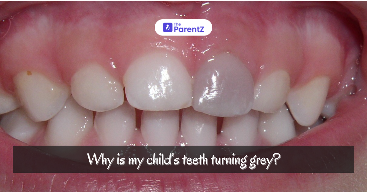 Why Is My Child’s Tooth Turning Grey? Causes, Solutions, and Prevention