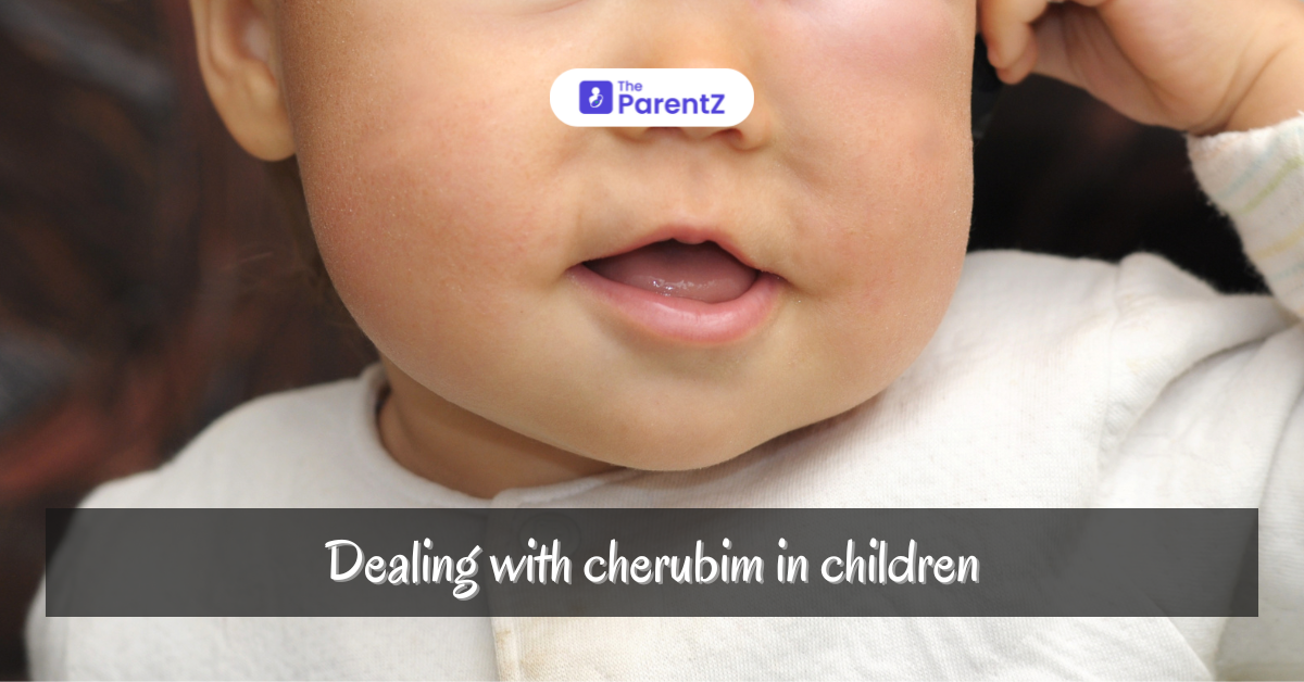 Understanding Cherubism in Children: Early Detection and Dental Care