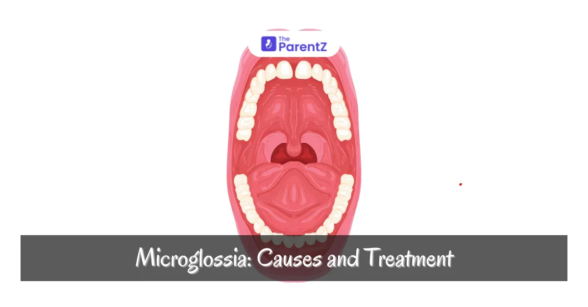 Microglossia : Causes and Treatment