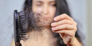 Coping with Postpartum Hair Loss: Solutions and Support