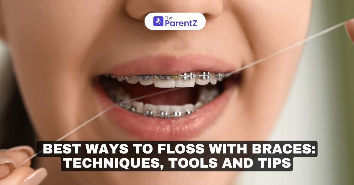 Best Ways to Floss with Braces: Techniques, Tools, and Tips