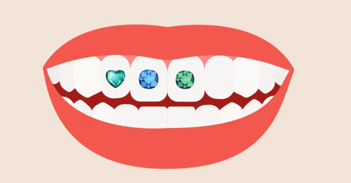 Dental Jewels for Kids: Fun Facts, Safety, and What to Know