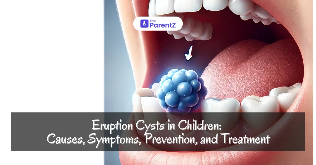 Eruption Cysts in Children: Causes, Symptoms, Prevention, and Treatment