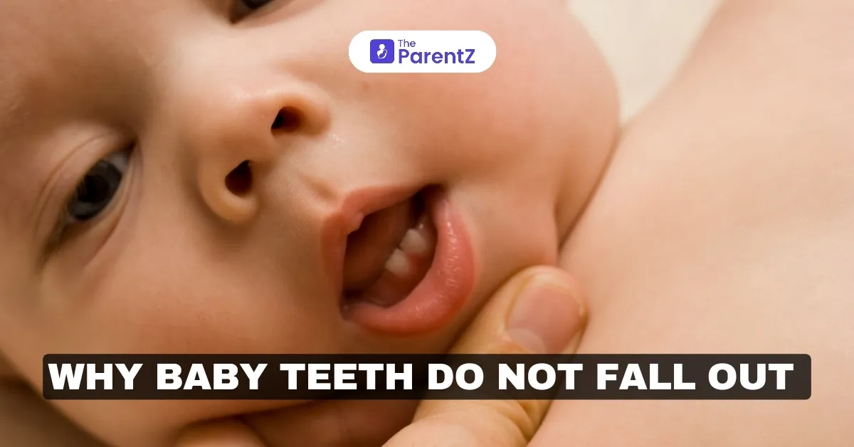 Why Baby Teeth Do Not Fall Out: Causes and Solutions for Retained Primary Teeth