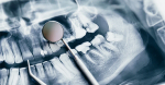 The role of Dental Radiology in Diagnosis