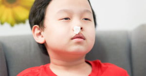 Understanding Nosebleeds in Children: Causes, Prevention, and First Aid