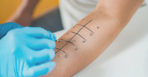 Allergy Testing: How To Diagnose an Allergy