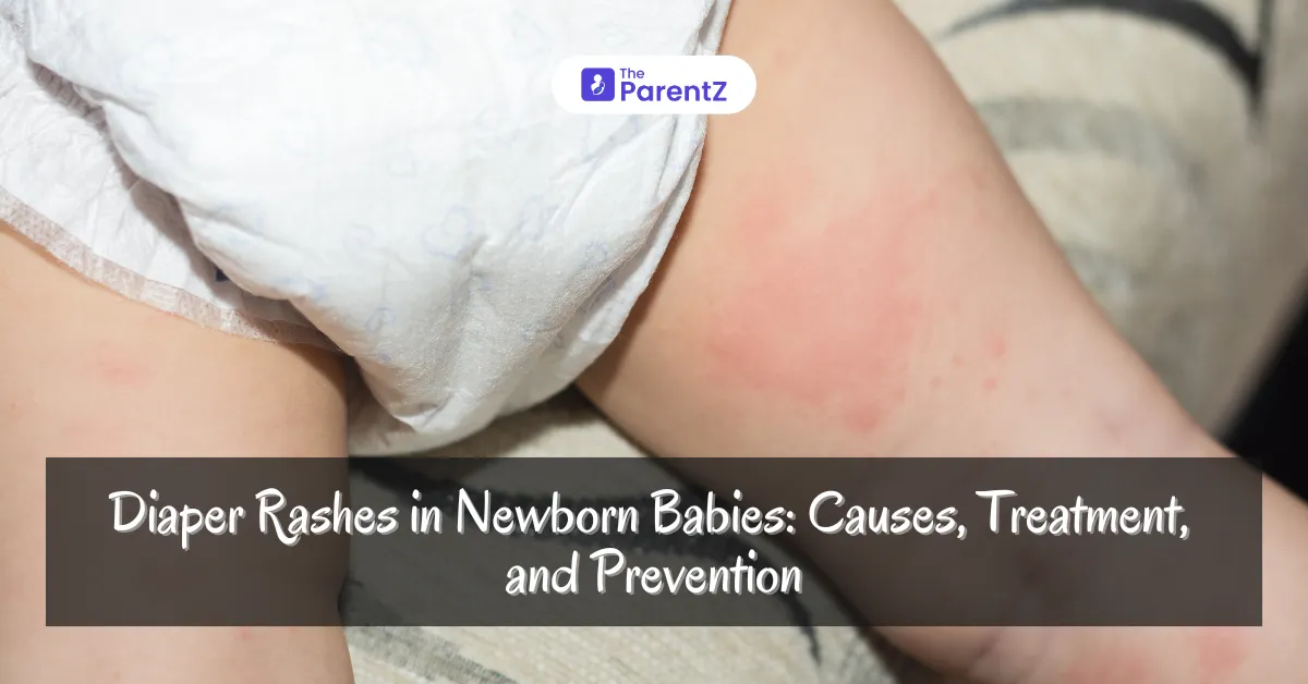 Diaper Rashes in Newborn Babies: Causes, Treatment, and Prevention