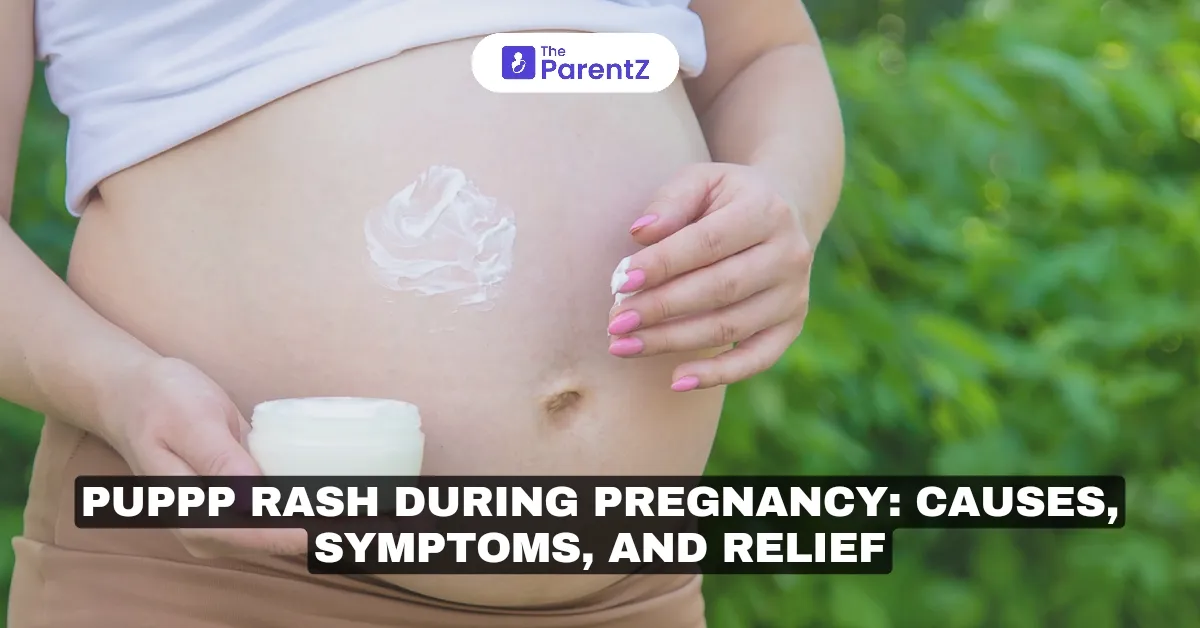 PUPPP Rash During Pregnancy: Causes, Symptoms, and Relief