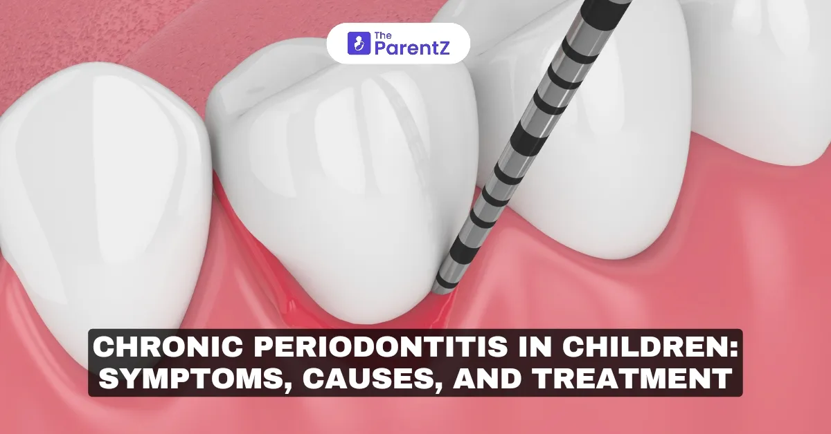 Chronic Periodontitis in Children: Symptoms, Causes, and Treatment