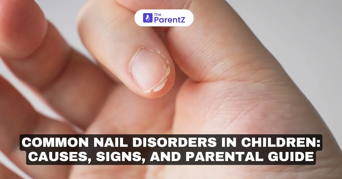 Common Nail Disorders in Children: Causes, Signs, and Parental Guide