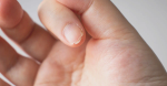 Common Nail Disorders in Children: Causes, Signs, and Parental Guide