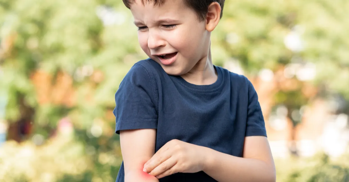 Insect Bites: What to Do When Your Child Gets Stung