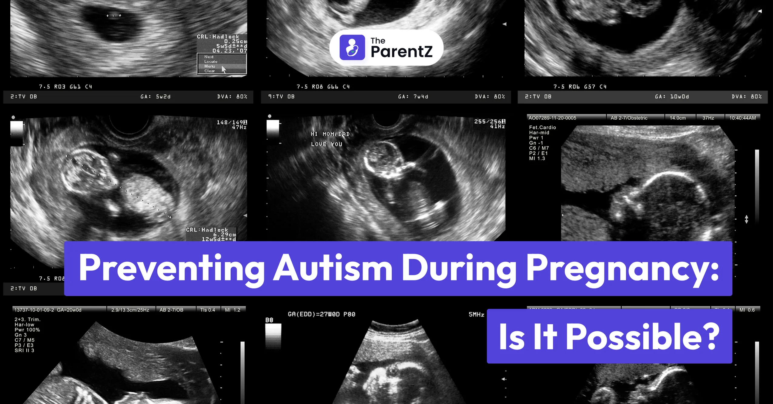 Preventing Autism During Pregnancy: Is It Possible?