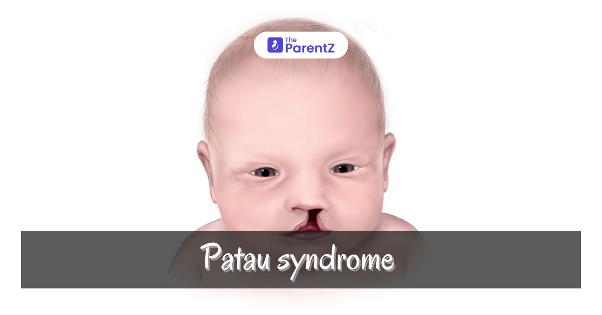 Patau syndrome