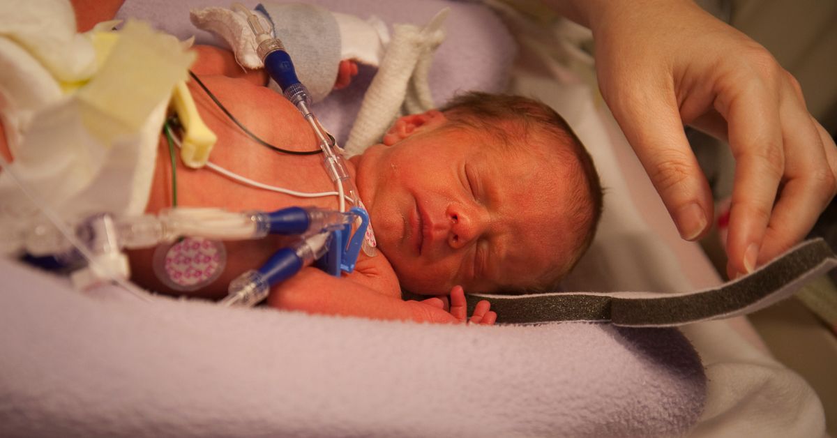 Caring for Preemies: Special Considerations