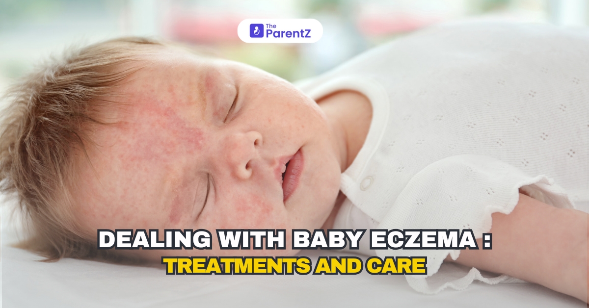 Dealing with Baby Eczema: Treatments and Care