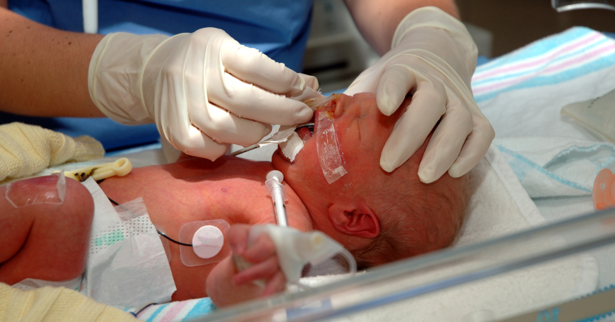 Understanding Neonatal Sepsis: Early Signs and Importance of Early Detection