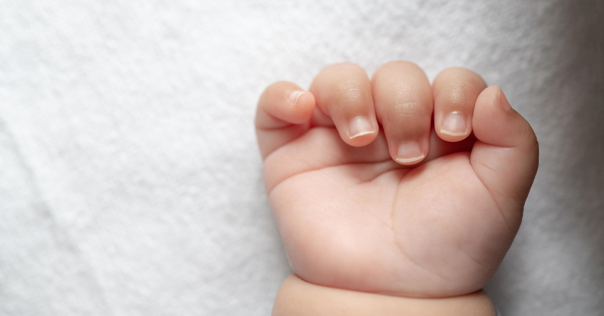 Understanding Your Baby’s Unusual Palm Lines and What They Might Mean