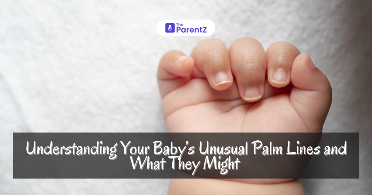 Understanding Your Baby’s Unusual Palm Lines and What They Might Mean