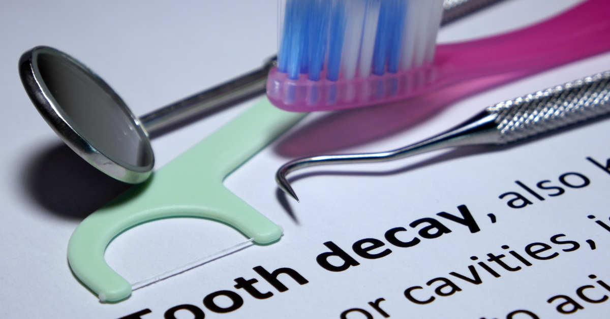 Baby Bottle Tooth Decay: Causes and Prevention