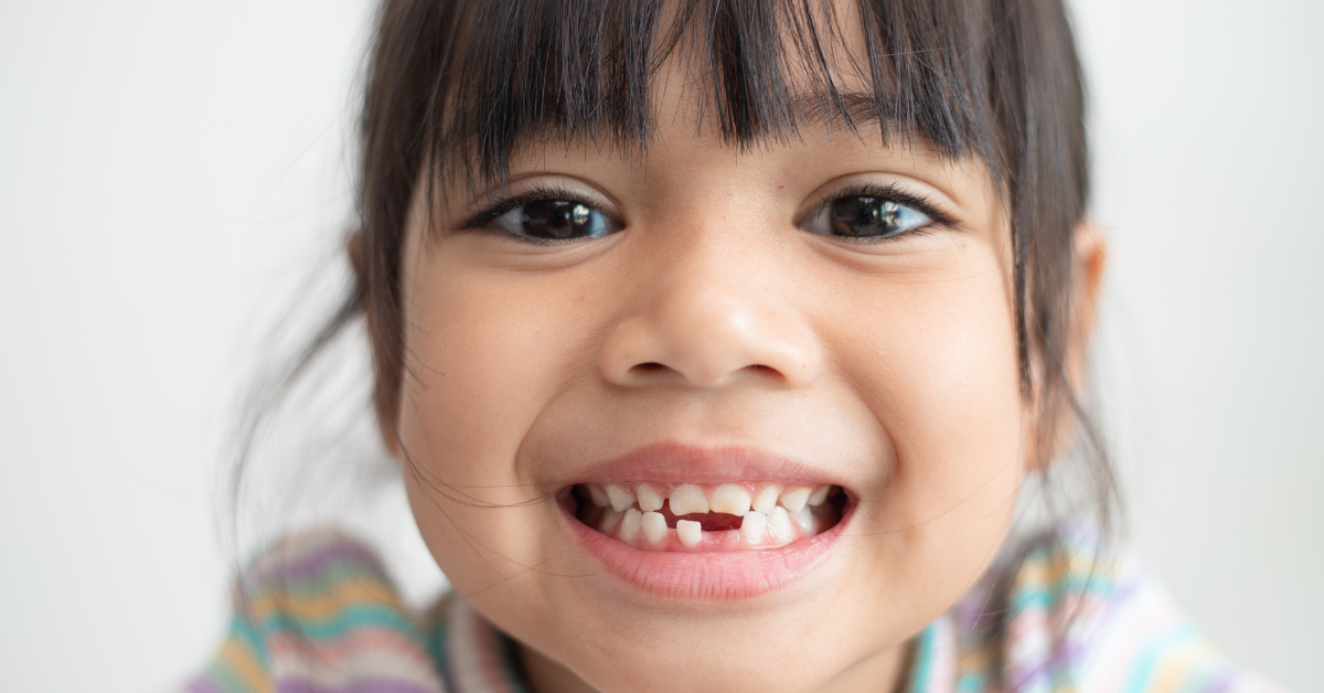 How to Handle a Broken Tooth in Kids