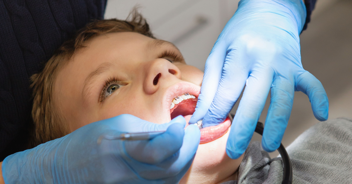 Orthodontic Treatments for Kids: When to Consider Braces