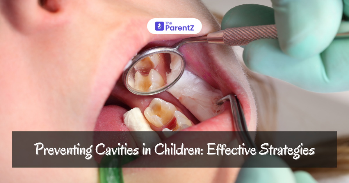 Preventing Cavities in Children: Effective Strategies