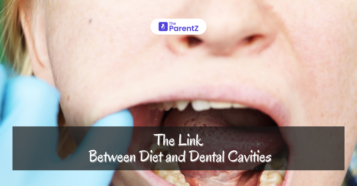 The Link Between Diet and Dental Cavities In Kids